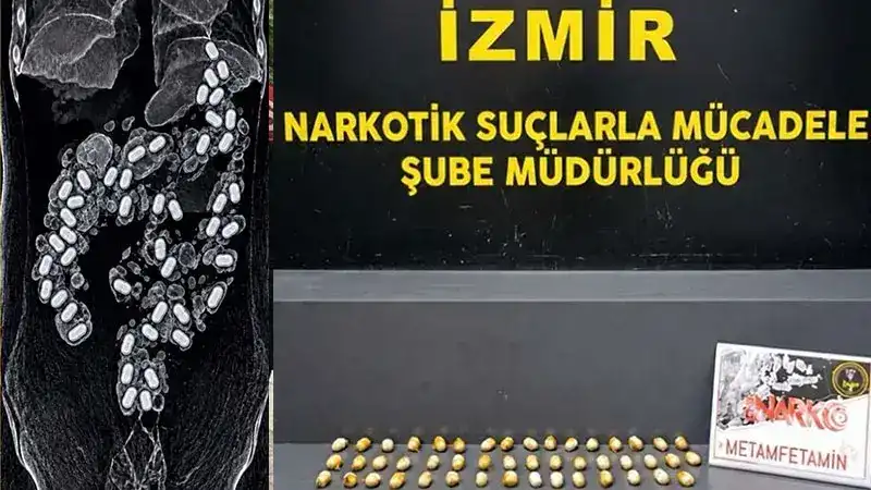 Havalimanında şüpheli yolcunun midesinden 322 gram metamfetamin çıktı