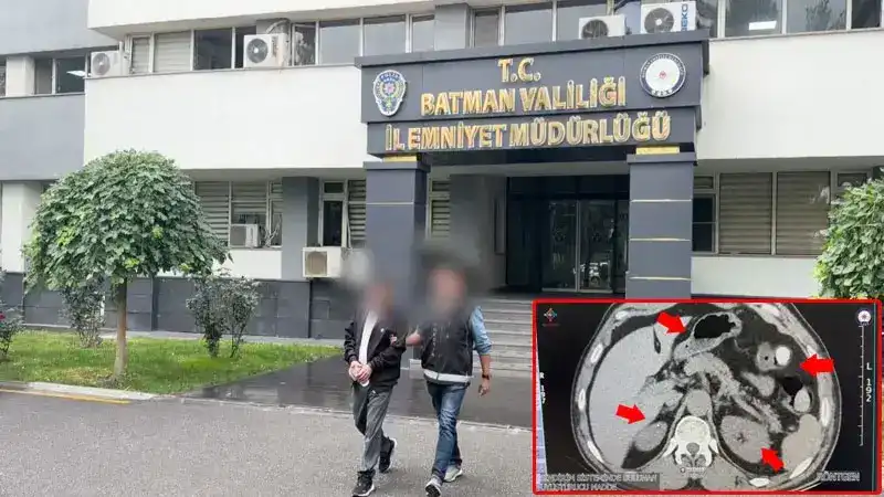 Midesinden uyuşturucu çıkan şüpheli tutuklandı